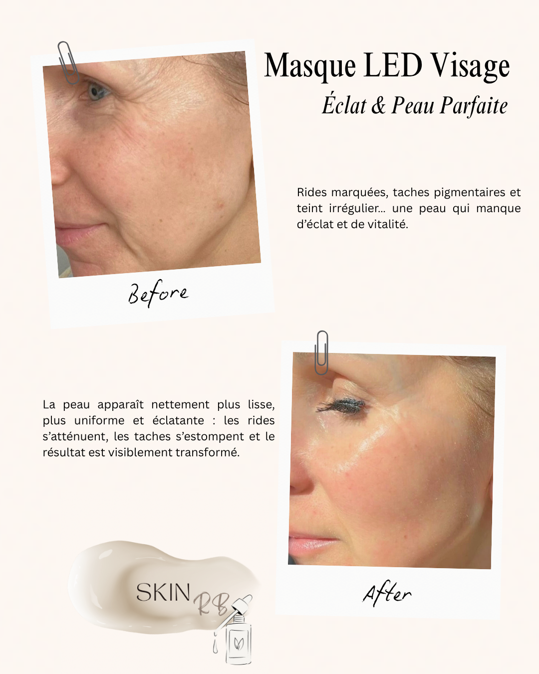 Masque LED Visage Sublimant