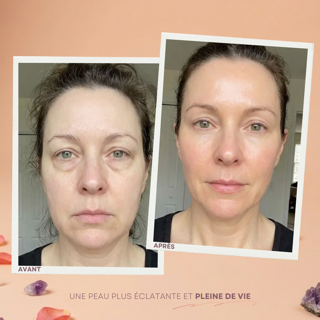 Masque LED Visage Sublimant