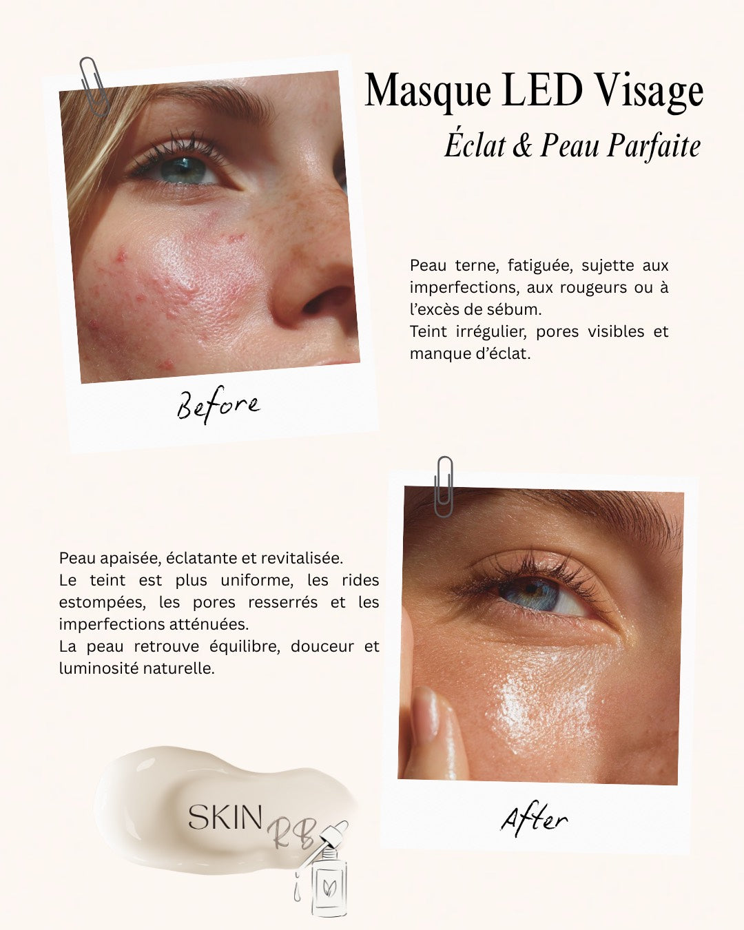 Masque LED visage Sublimant