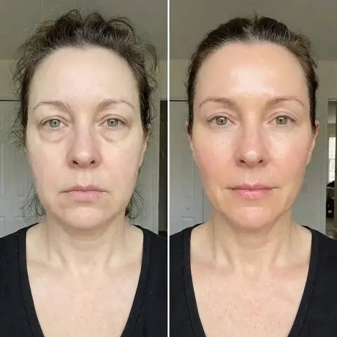 Un regard moins fatigué — avant et après