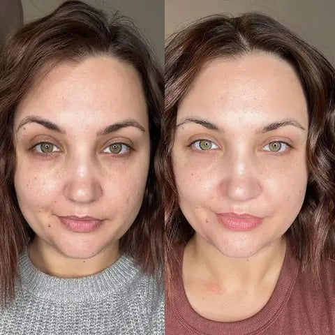 Un grain de peau affiné — avant et après